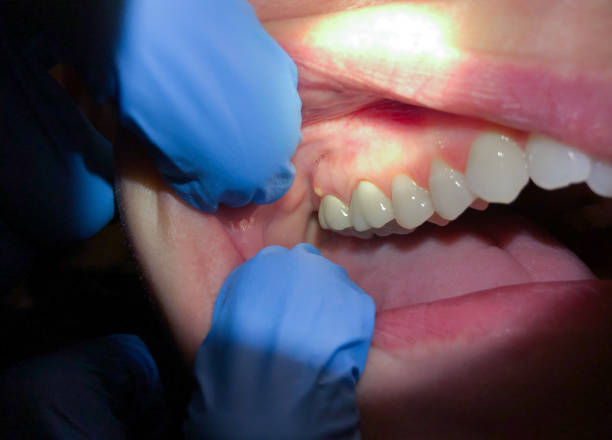 Best Weekend Emergency Dental Services in Charlottesville, VA